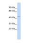 Lysosomal acid phosphatase antibody, NBP1-62491, Novus Biologicals, Western Blot image 