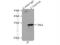 RNA Transcription, Translation And Transport Factor antibody, 19848-1-AP, Proteintech Group, Immunoprecipitation image 