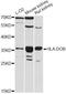 Major Histocompatibility Complex, Class II, DO Beta antibody, LS-C747409, Lifespan Biosciences, Western Blot image 