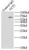 Chaperonin Containing TCP1 Subunit 5 antibody, FNab01400, FineTest, Immunoprecipitation image 