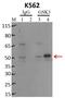 Glycogen Synthase Kinase 3 Alpha antibody, MA3-038, Invitrogen Antibodies, Immunoprecipitation image 