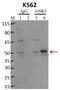 Glycogen Synthase Kinase 3 Alpha antibody, MA3-038, Invitrogen Antibodies, Immunoprecipitation image 