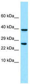 Platelet Derived Growth Factor Receptor Like antibody, TA331218, Origene, Western Blot image 