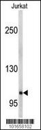 EPH Receptor A5 antibody, 63-045, ProSci, Western Blot image 