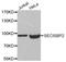 SECIS Binding Protein 2 antibody, STJ25466, St John