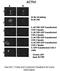 Actinin Alpha 1 antibody, 27-160, ProSci, Immunohistochemistry paraffin image 