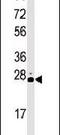 Serine/Threonine Kinase 19 antibody, PA5-14005, Invitrogen Antibodies, Western Blot image 