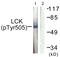 LCK Proto-Oncogene, Src Family Tyrosine Kinase antibody, LS-C199195, Lifespan Biosciences, Western Blot image 