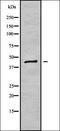 Diacylglycerol O-Acyltransferase 2 antibody, orb338238, Biorbyt, Western Blot image 