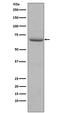 Eukaryotic Translation Initiation Factor 2 Alpha Kinase 2 antibody, P01384, Boster Biological Technology, Western Blot image 