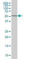 Cyclin Dependent Kinase 8 antibody, H00001024-M04, Novus Biologicals, Western Blot image 