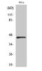 Interferon Regulatory Factor 3 antibody, STJ93763, St John