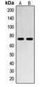 SUMO Specific Peptidase 1 antibody, LS-C353417, Lifespan Biosciences, Western Blot image 