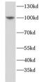 Multiple C2 And Transmembrane Domain Containing 2 antibody, FNab05069, FineTest, Western Blot image 