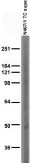 Potassium Two Pore Domain Channel Subfamily K Member 18 antibody, 73-475, Antibodies Incorporated, Western Blot image 