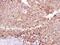 Caseinolytic Mitochondrial Matrix Peptidase Proteolytic Subunit antibody, PA5-21591, Invitrogen Antibodies, Immunohistochemistry paraffin image 