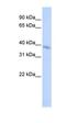 Transmembrane Protein 82 antibody, orb325180, Biorbyt, Western Blot image 