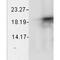 Crystallin Alpha B antibody, MA5-27708, Invitrogen Antibodies, Western Blot image 