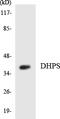 Deoxyhypusine Synthase antibody, LS-C291876, Lifespan Biosciences, Western Blot image 