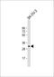 Insulin Like Growth Factor Binding Protein 5 antibody, 61-192, ProSci, Western Blot image 