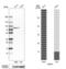 NEDD1 Gamma-Tubulin Ring Complex Targeting Factor antibody, PA5-58455, Invitrogen Antibodies, Western Blot image 