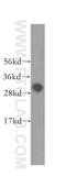 Survival Motor Neuron Domain Containing 1 antibody, 12178-1-AP, Proteintech Group, Western Blot image 