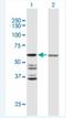 Acyl-CoA Thioesterase 2 antibody, H00010965-B01P-50ug, Novus Biologicals, Western Blot image 