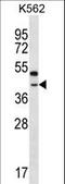 Olfactory Receptor Family 6 Subfamily Q Member 1 (Gene/Pseudogene) antibody, LS-C163245, Lifespan Biosciences, Western Blot image 
