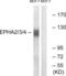 Ephrin type-A receptor 2 antibody, LS-C117887, Lifespan Biosciences, Western Blot image 