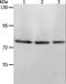 Acyl-CoA Oxidase 1 antibody, LS-C401158, Lifespan Biosciences, Western Blot image 