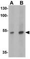 Transcription Factor CP2 Like 1 antibody, GTX31477, GeneTex, Western Blot image 
