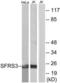 Serine And Arginine Rich Splicing Factor 3 antibody, LS-B6172, Lifespan Biosciences, Western Blot image 