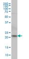 NFKB Inhibitor Interacting Ras Like 2 antibody, H00028511-M02, Novus Biologicals, Western Blot image 