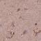 Sorcin antibody, PA5-64975, Invitrogen Antibodies, Immunohistochemistry frozen image 