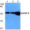 Heterogeneous Nuclear Ribonucleoprotein K antibody, A01793Y280, Boster Biological Technology, Western Blot image 