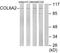 Collagen Type VI Alpha 2 Chain antibody, LS-C119464, Lifespan Biosciences, Western Blot image 