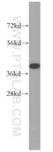 NFKB Inhibitor Alpha antibody, 51066-1-AP, Proteintech Group, Western Blot image 