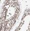 Crmp2 antibody, FNab01986, FineTest, Immunohistochemistry paraffin image 