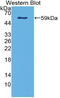 Netrin-4 antibody, LS-C314835, Lifespan Biosciences, Western Blot image 