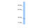 NOP2/Sun RNA Methyltransferase 3 antibody, ARP48884_P050, Aviva Systems Biology, Western Blot image 