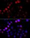 Cytochrome P450 Family 19 Subfamily A Member 1 antibody, LS-C747771, Lifespan Biosciences, Immunofluorescence image 