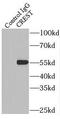 SS18L1 Subunit Of BAF Chromatin Remodeling Complex antibody, FNab01971, FineTest, Immunoprecipitation image 