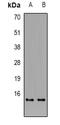 Tubulin Alpha 1a antibody, orb382595, Biorbyt, Western Blot image 