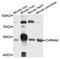 Neuronal acetylcholine receptor subunit alpha-6 antibody, A06421, Boster Biological Technology, Western Blot image 