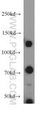 Death Domain Associated Protein antibody, 20489-1-AP, Proteintech Group, Western Blot image 