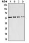 Activating Transcription Factor 2 antibody, LS-C353952, Lifespan Biosciences, Western Blot image 