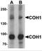 Vacuolar Protein Sorting 13 Homolog B antibody, NBP2-82052, Novus Biologicals, Western Blot image 