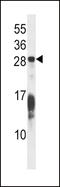 RAP1B, Member Of RAS Oncogene Family antibody, 58-039, ProSci, Western Blot image 