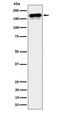 CAP-Gly Domain Containing Linker Protein 1 antibody, M08907, Boster Biological Technology, Western Blot image 