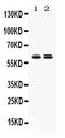 Chaperonin Containing TCP1 Subunit 5 antibody, PA5-78955, Invitrogen Antibodies, Western Blot image 